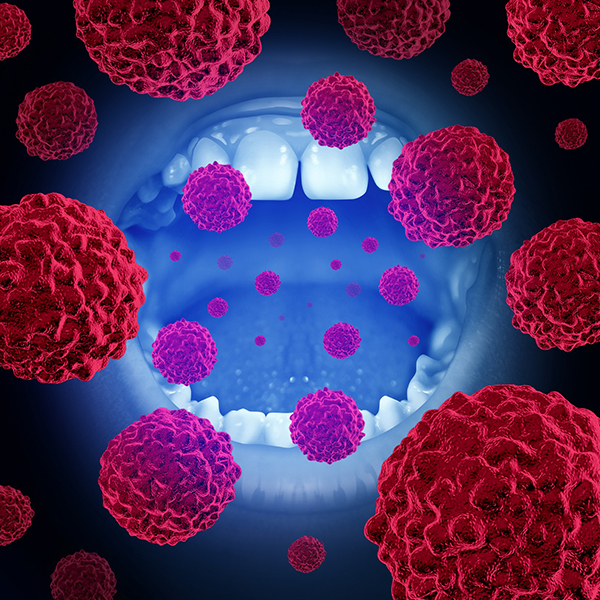 Screening Oral - Depistare Cancer Oral